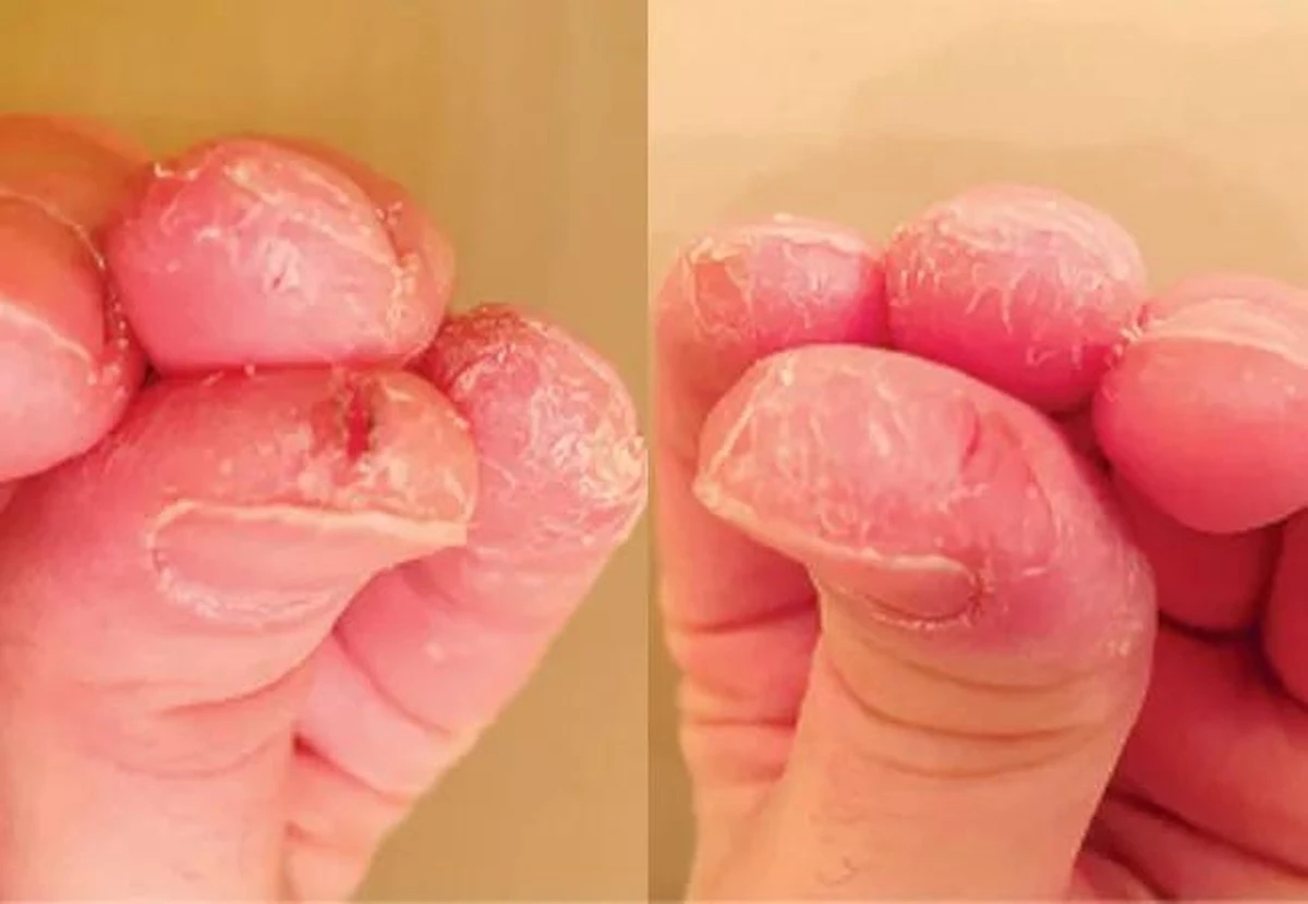 Tandpasta op je koppelingen: waarom monteurs dit jarenlang stil houden