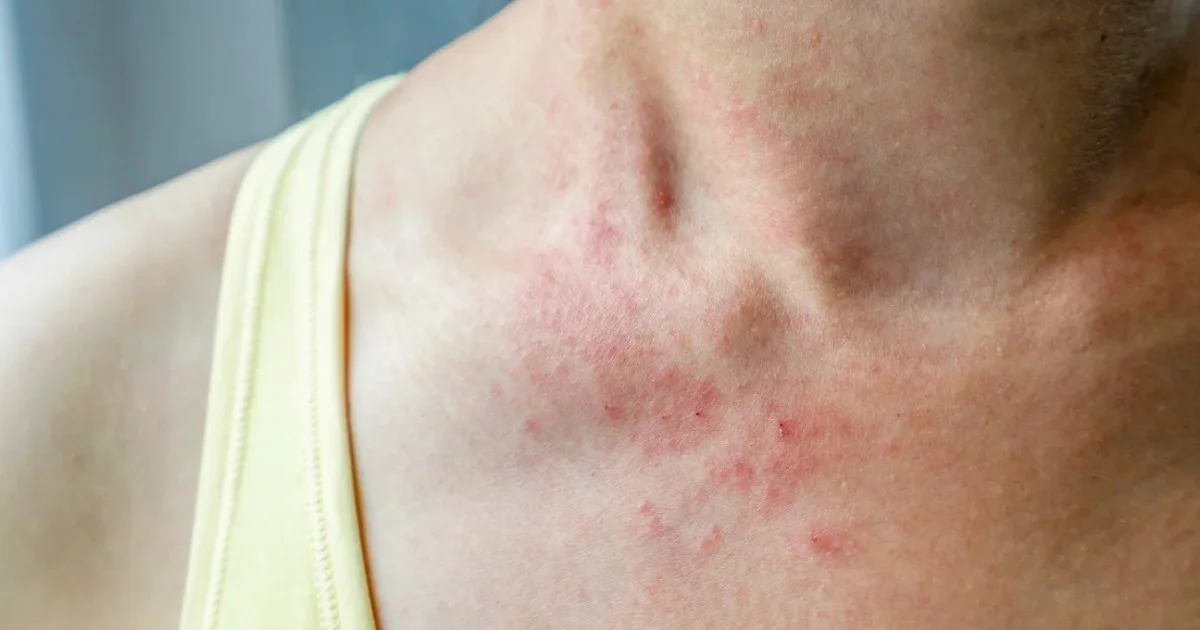 Bakingsoda op je matras: het anti-allergie ritueel dat je slaap transformeert - image 2