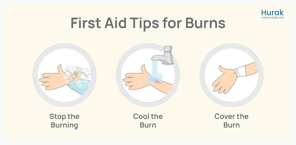 Boter op brandwonden? Dit huishoudmiddel dat je nooit dacht te gebruiken